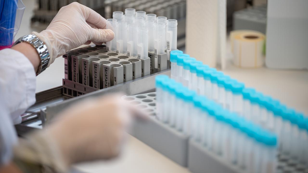 PCR-Tests: Grünen-Experte für Priorisierung