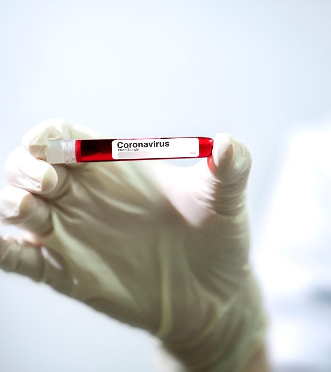 Probe mit Coronavirus