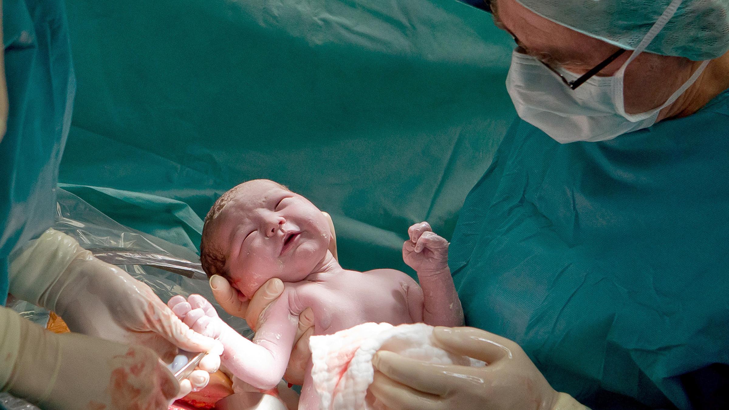 Per Kaiserschnitt zur Welt gebrachtes Baby