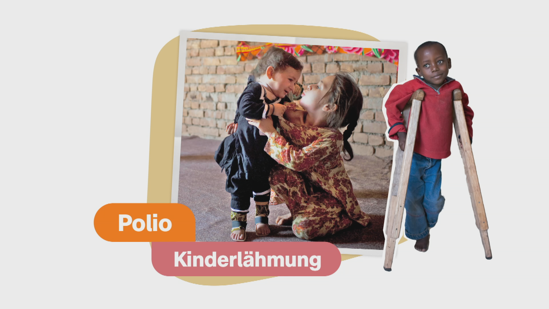 Grafik: Krankheit Polio