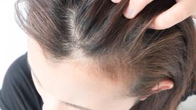 Close-up of a woman's hand combing her hairline with her fingers.