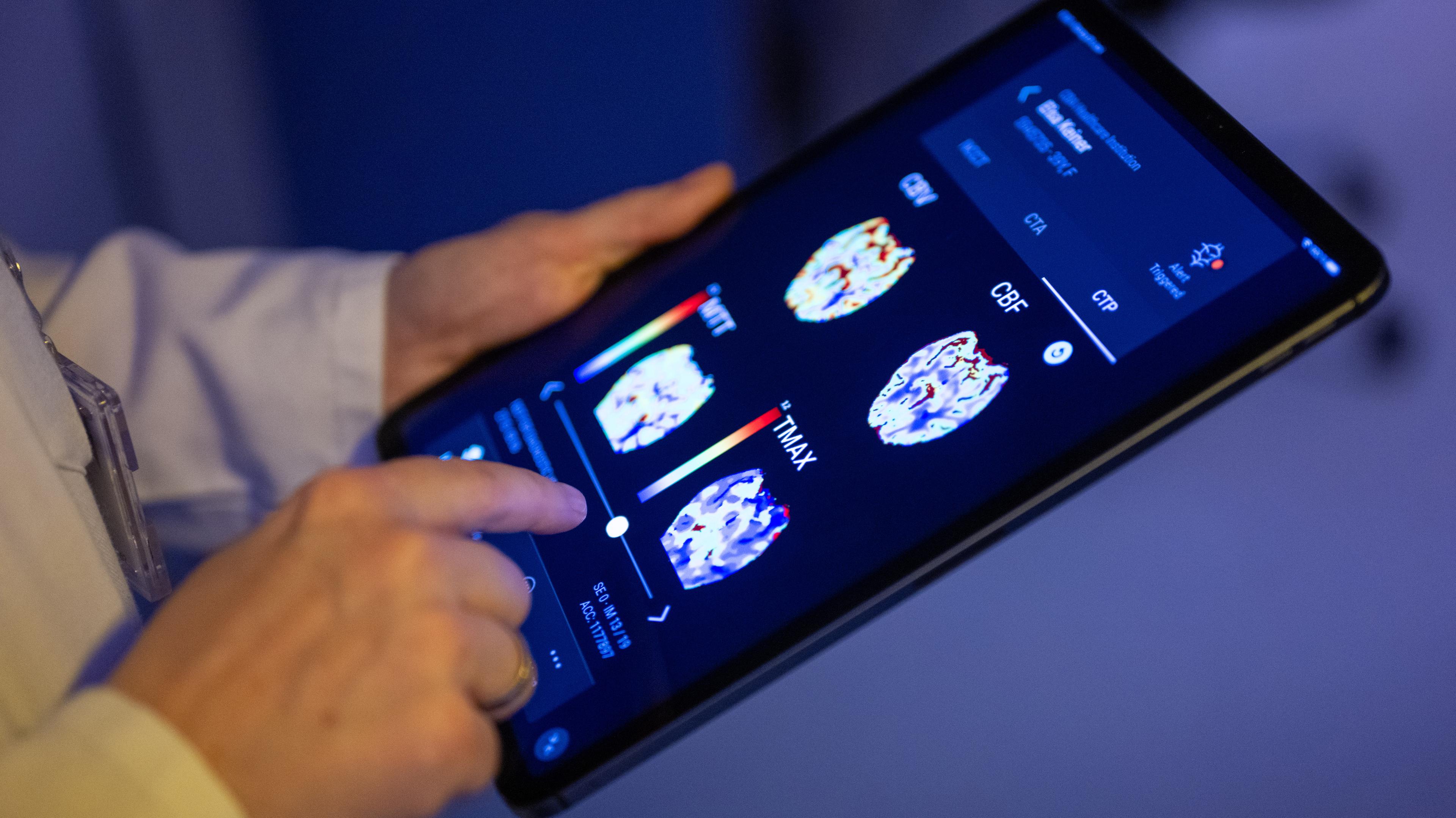 Berlin: Eine Radiologin im Unfallkrankenhaus Berlin betrachtet in einer KI-basierten App auf einem Tablet Gehirnbilder eines Patienten.