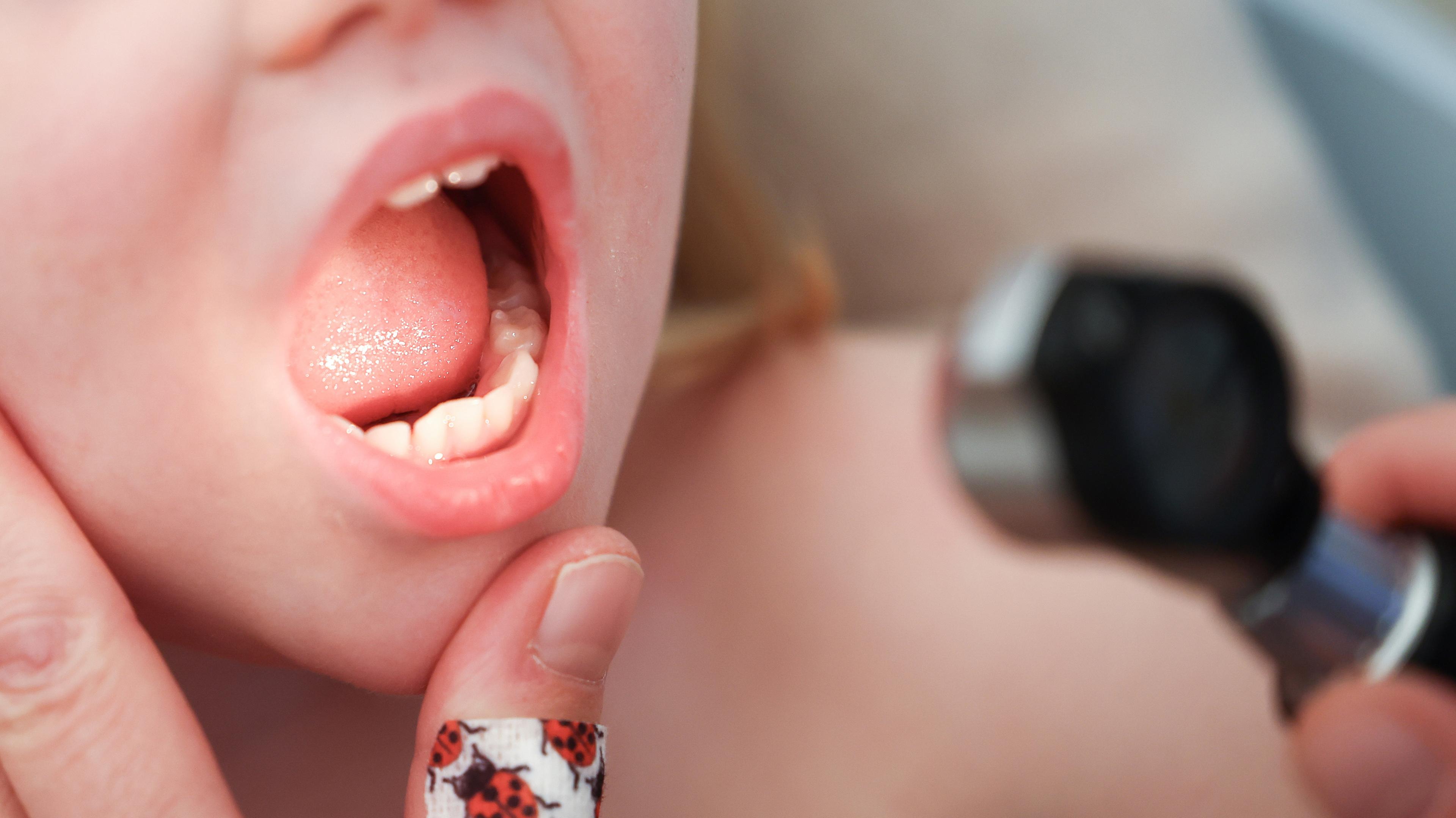 Mit einem Otoskop untersucht eine Kinderärztin den Mund und Hals eines Mädchens im Rahmen einer U9-Untersuchung. 