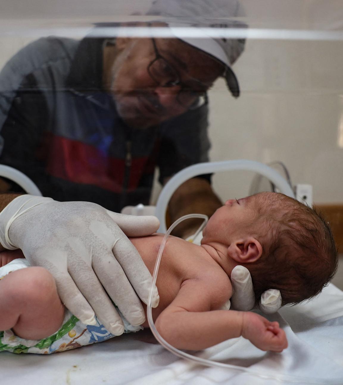 Das Baby Malek Yasine, das per Kaiserschnitt entbunden wurde, nachdem seine im neunten Monat schwangere Mutter ihren Verletzungen erlegen war am 20.07.2024.