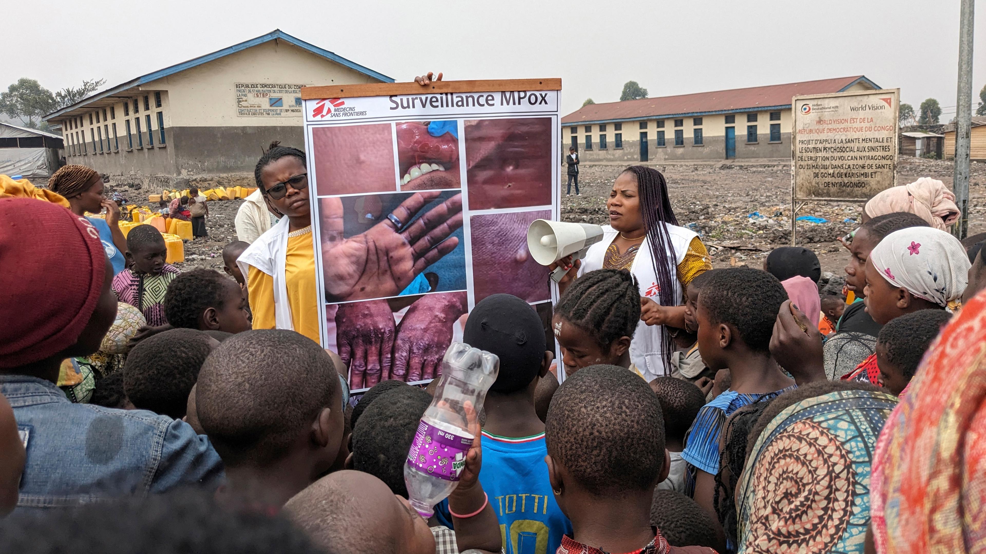 Dieses von Ärzte ohne Grenzen (Ärzte ohne Grenzen) bereitgestellte Foto vom 31. Mai 2023 zeigt Gesundheitspersonal, das Kinder über die Symptome der MPOX-Krankheit in Goma, Kongo, aufklärt. 