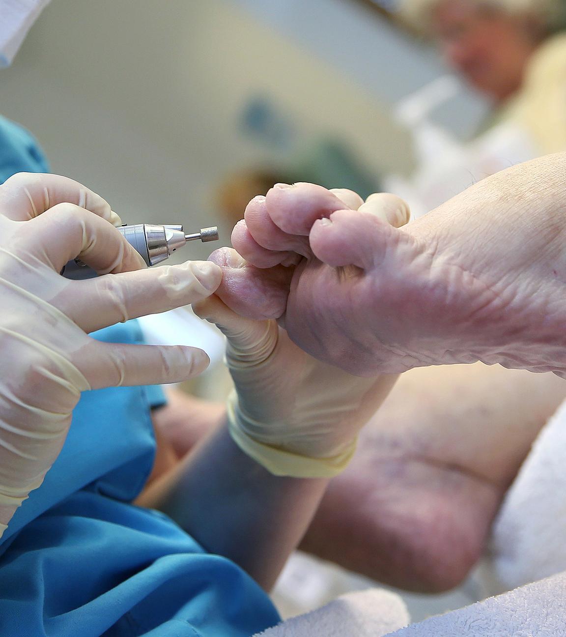 Eine medizinisch geschulte Person reinigt die Zehennägel einer Patientin.