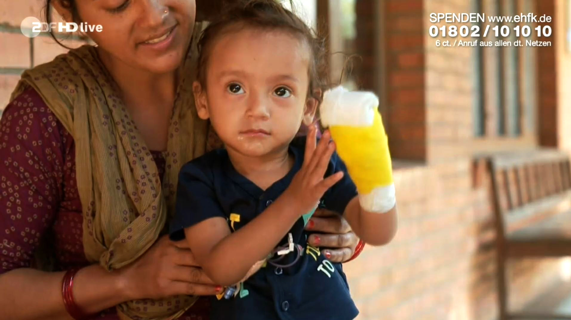 Medizinische Hilfe für Kinder in Nepal