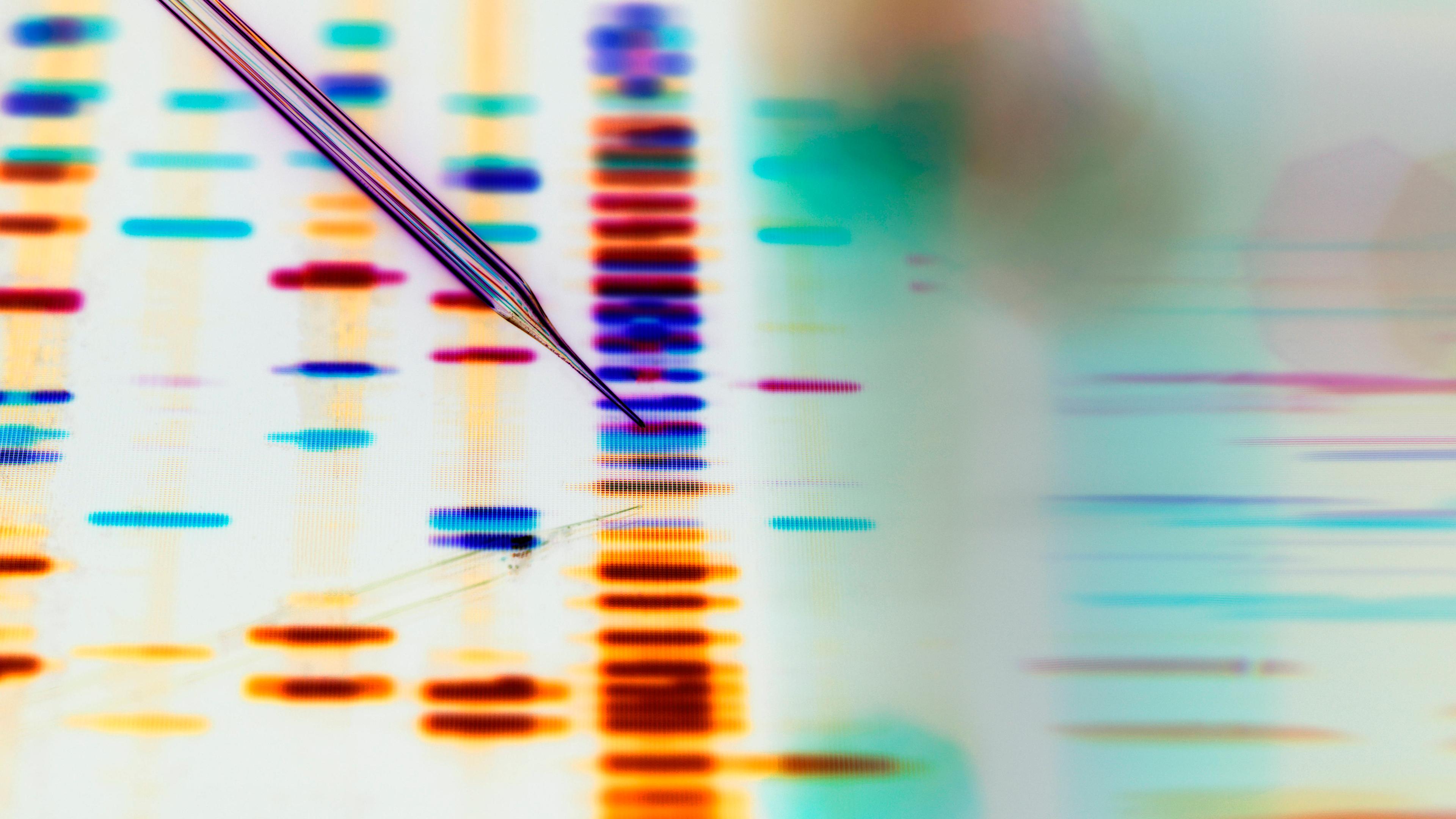 Eine Pipette wird über den Ausdruck einer DNA-Analyse gehalten.