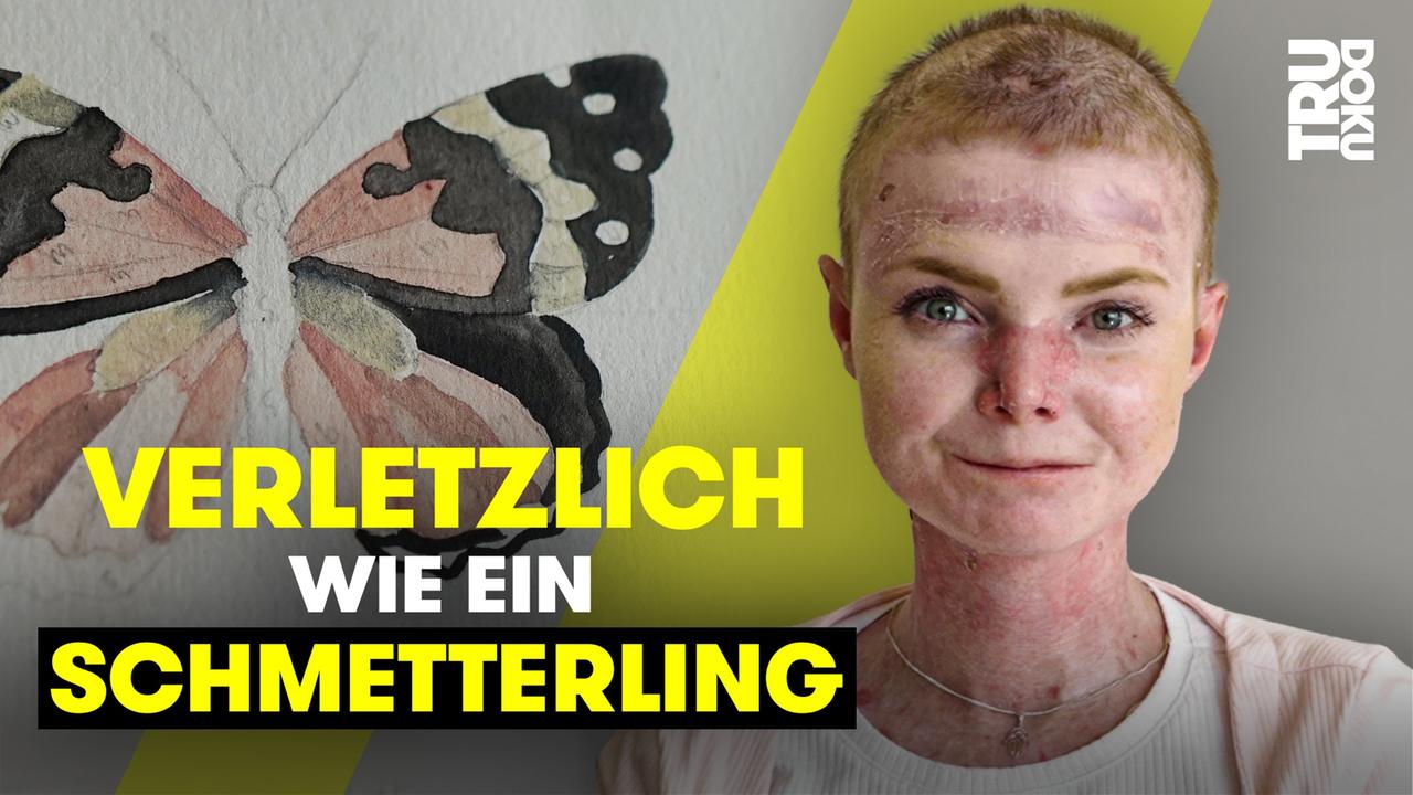 “Ich bin mehr als meine Krankheit!” - Julia (24) kämpft für ihre Träume -  TRU DOKU