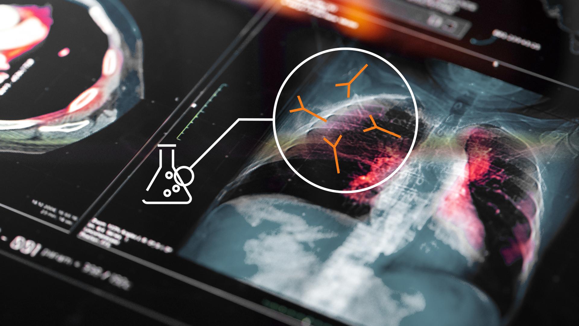 Im Video wird erklärt wie mRNA-Technologie funtkioniert und wo die Forschung steht. 